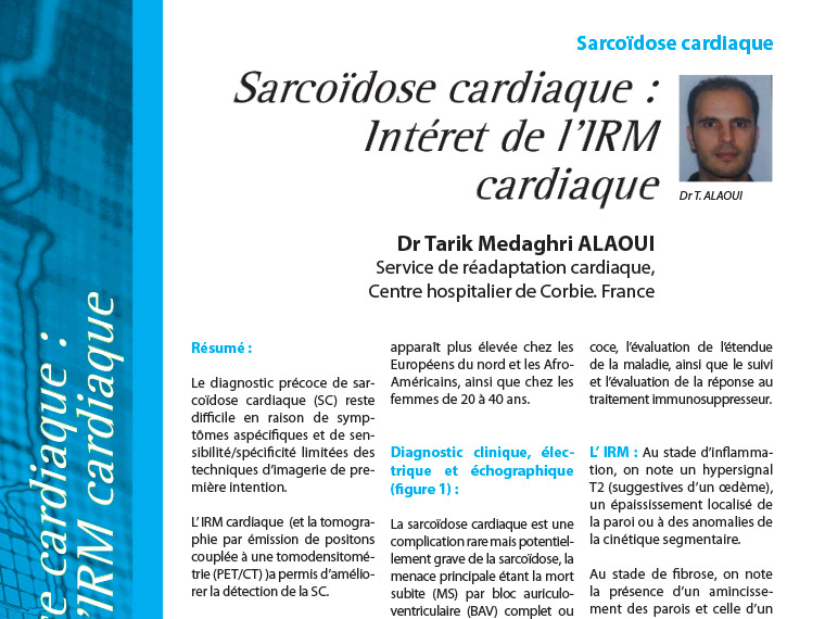 Sarcoïde cardiaque : Intéret de l'IRM cardiaque