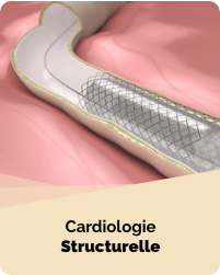 CNCH groupe Cardiologie Structurelle